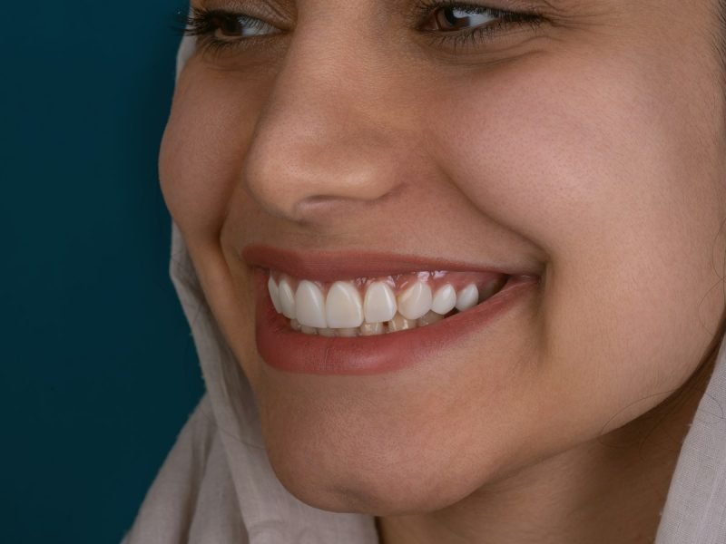 מגן dental